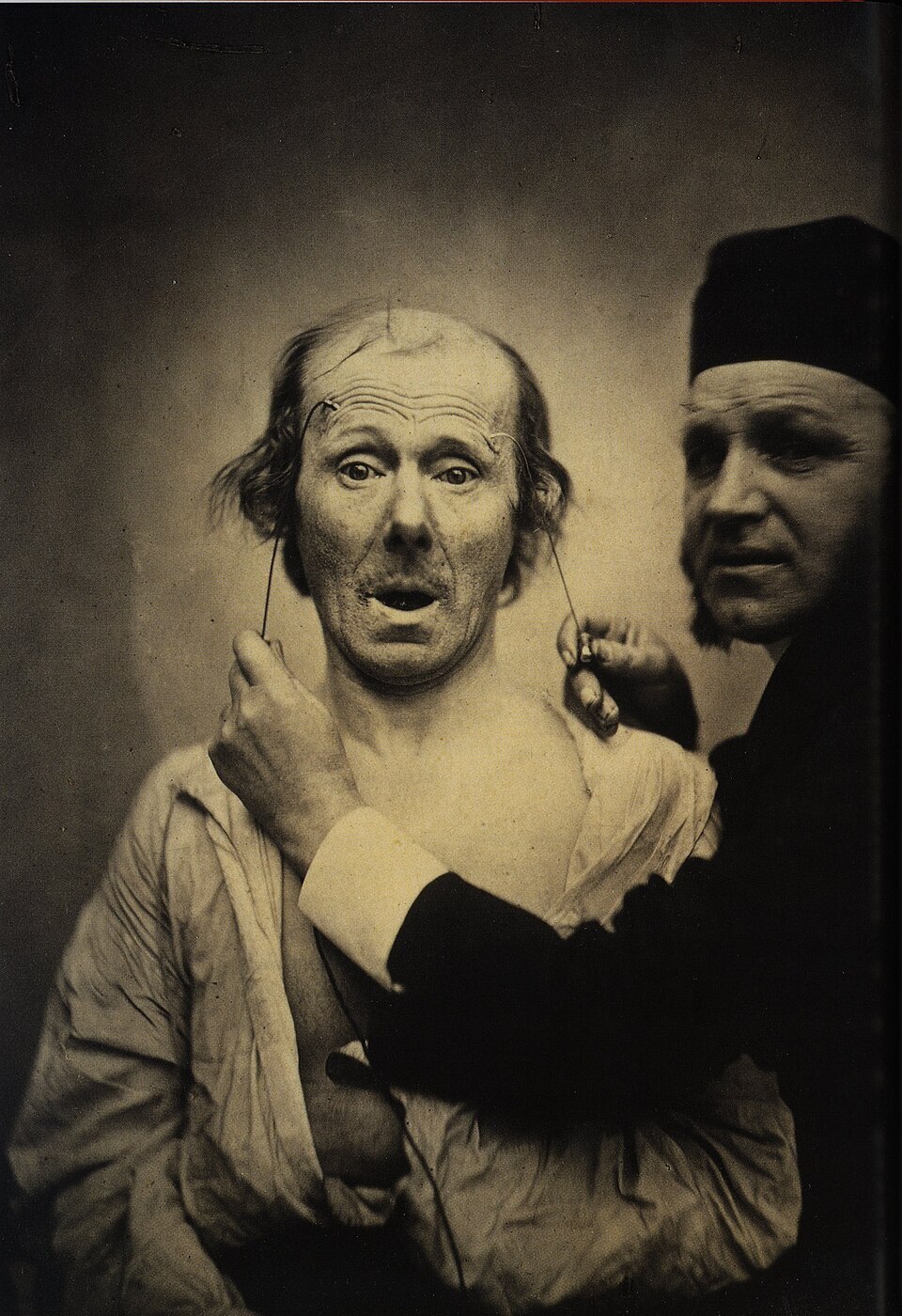 Grimaces savantes : autour de Duchenne de Boulogne